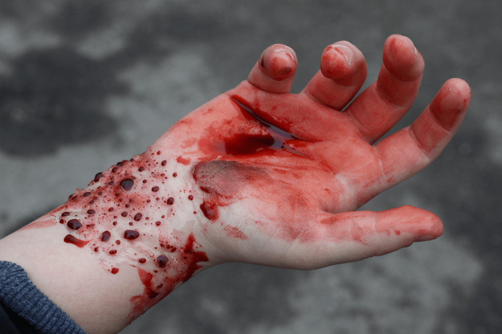 Blutige Hand Blutige Hand